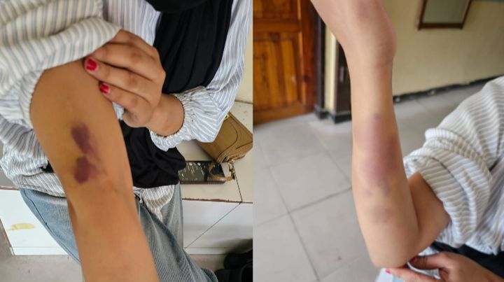 Oknum Polisi di Konawe Utara Dilaporkan Aniaya Kekasih, Kini Jalani Penahanan Khusus